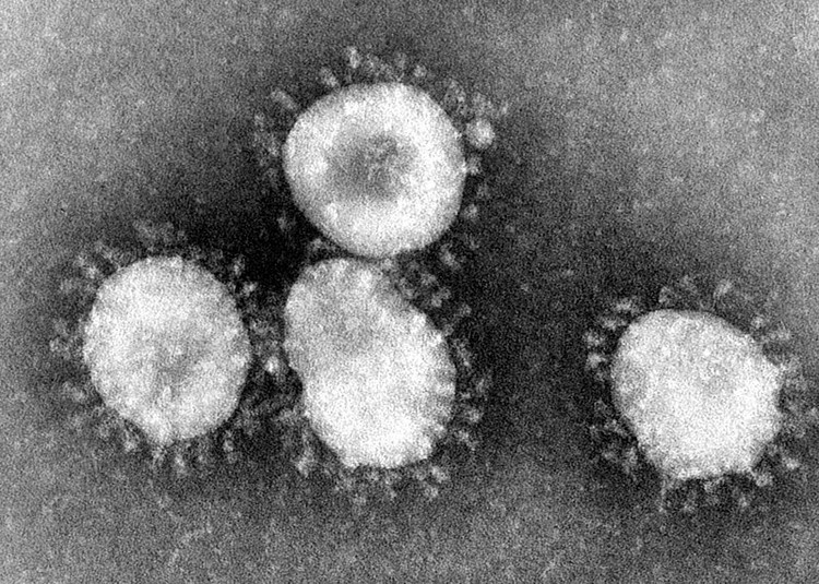 Photo of Coronaviruses