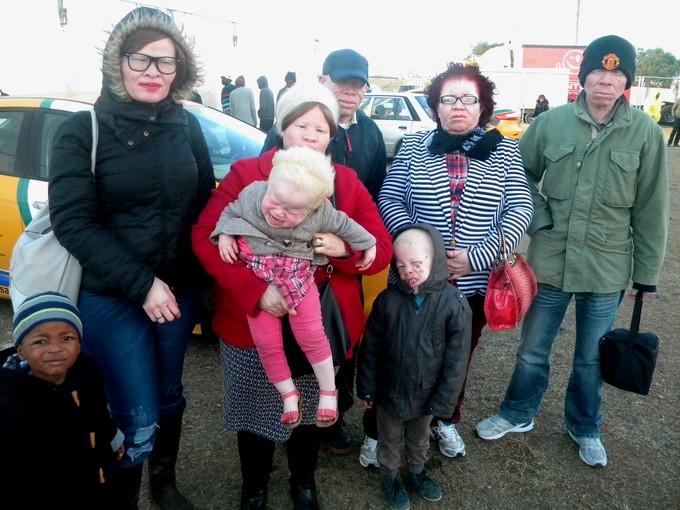 Photo of a group of people with albinism